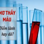 Nằm mơ thấy máu có phải điềm xui? Đánh số mấy trúng lớn?